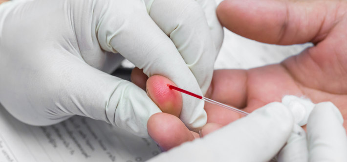 Берут анализ крови из пальца